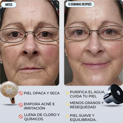 Cabezal de ducha con filtro - Purri